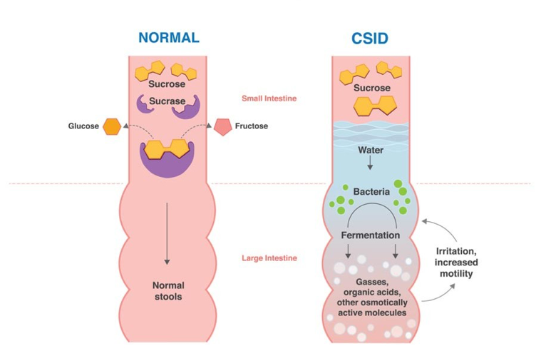 CSID-Intestine.png